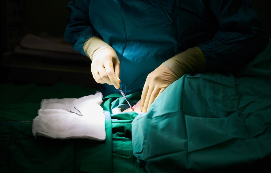 chirurgie