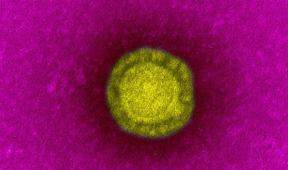 Coronavirus - agent du Sras © institut Pasteur ©